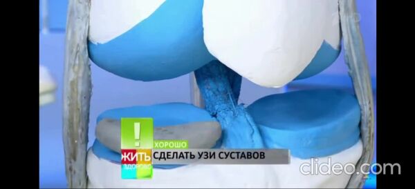 Loading video