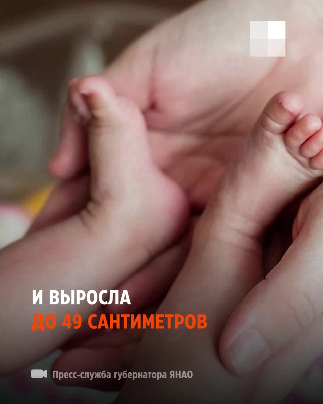 Екатеринбурженка родила недоношенную девочку, она весила всего 470 граммов:  видео - 22 мая 2024 - 59.ру