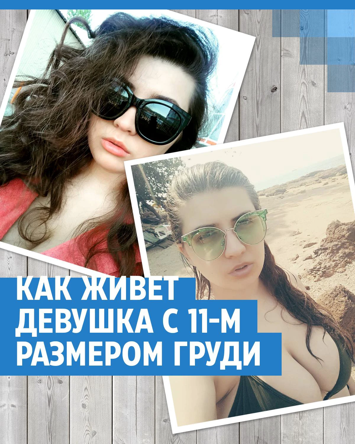 Самая красивая женщина мира из Владивостока: да, я сделала грудь, но губы — свои